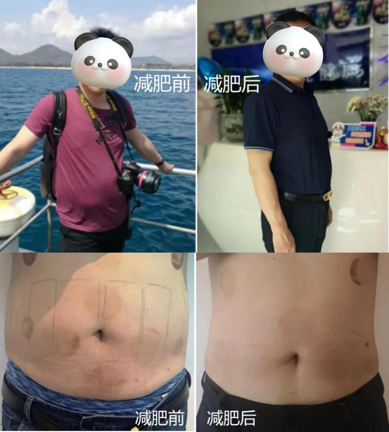 中年发福终究逃不过！不想吃减肥的苦，秀域减肥法让我轻松甩肉