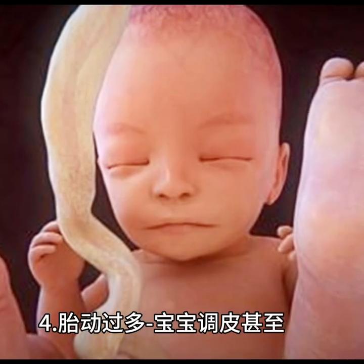 脐带打结跟脐带缠绕有什么区别,脐带绕颈一周有什么办法绕出来