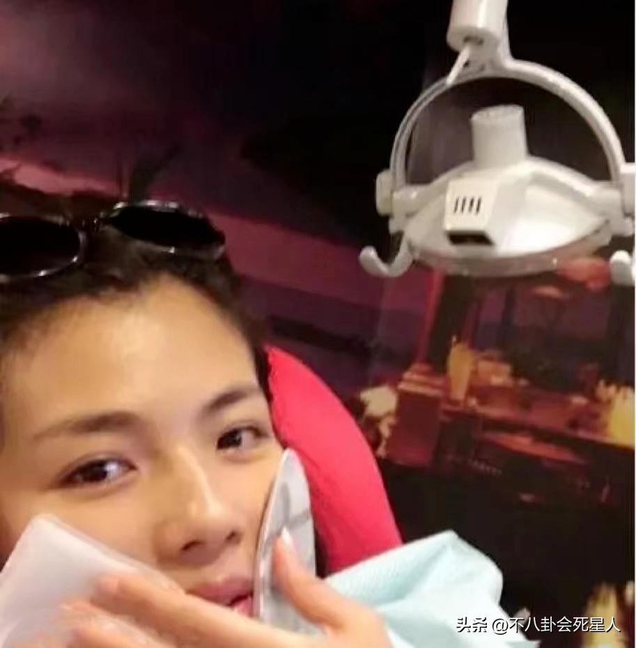 烤瓷牙有多恐怖,烤瓷牙害我一生