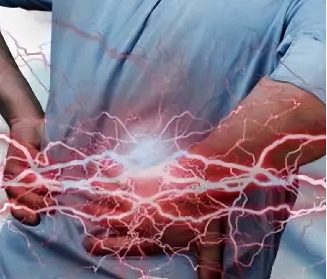 女子腰椎间盘突出,女性腰痛和腰椎间盘突出