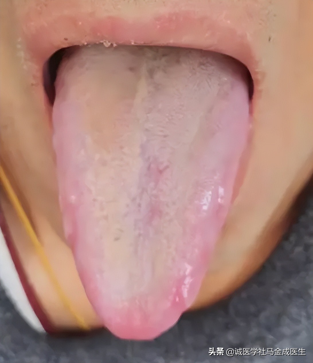 胃胀肚子胀有什么快速消食的方法,胃胀肚子胀最简单的快速解决