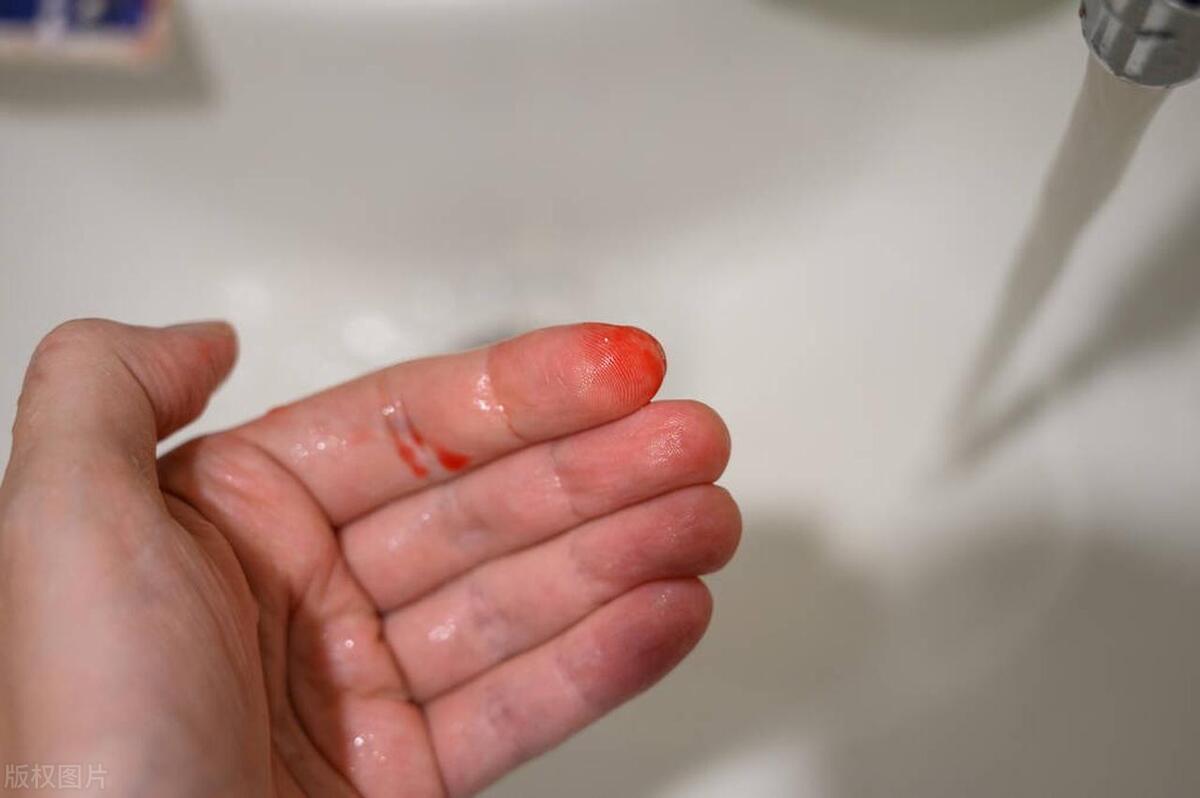 同房不是打仗：女性同房后出现这4种不适，当心疾病来临