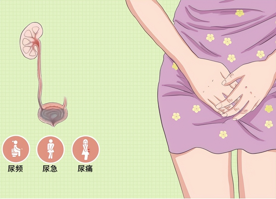 雌激素有助抵御尿路感染吗,雌激素导致的尿路感染