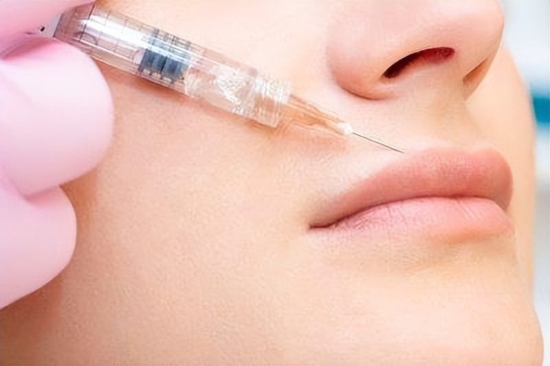 唇部丰满适合哪个医美项目,唇部做什么医美项目才能变浅色