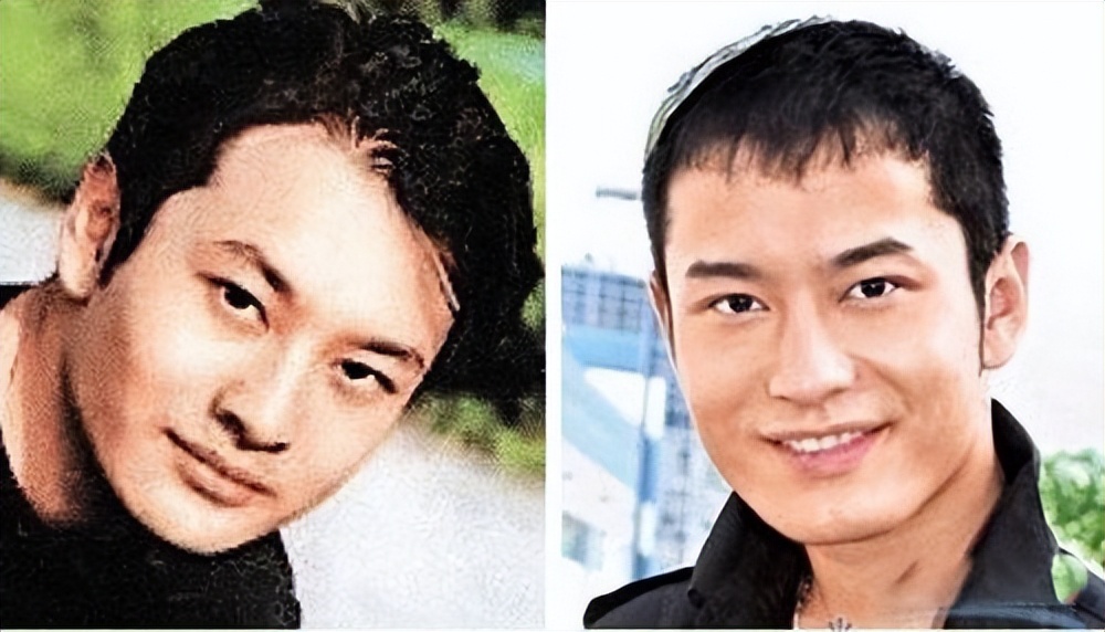 怎么不整容就能成为小v脸,不用整容也能变v脸吗