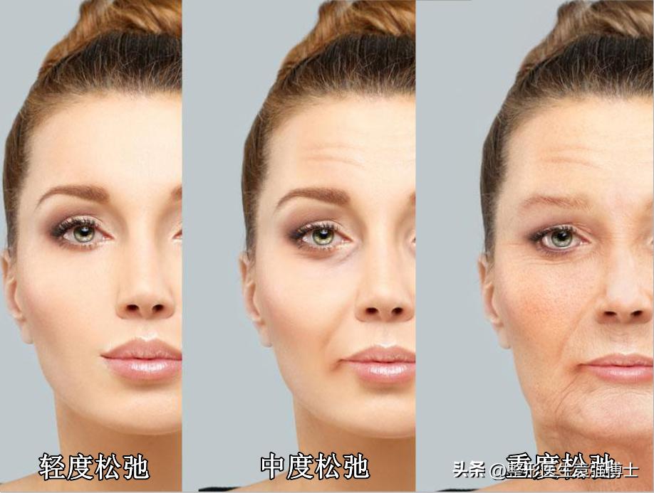 抗衰医美步骤有哪些项目,抗衰的医美项目有哪些