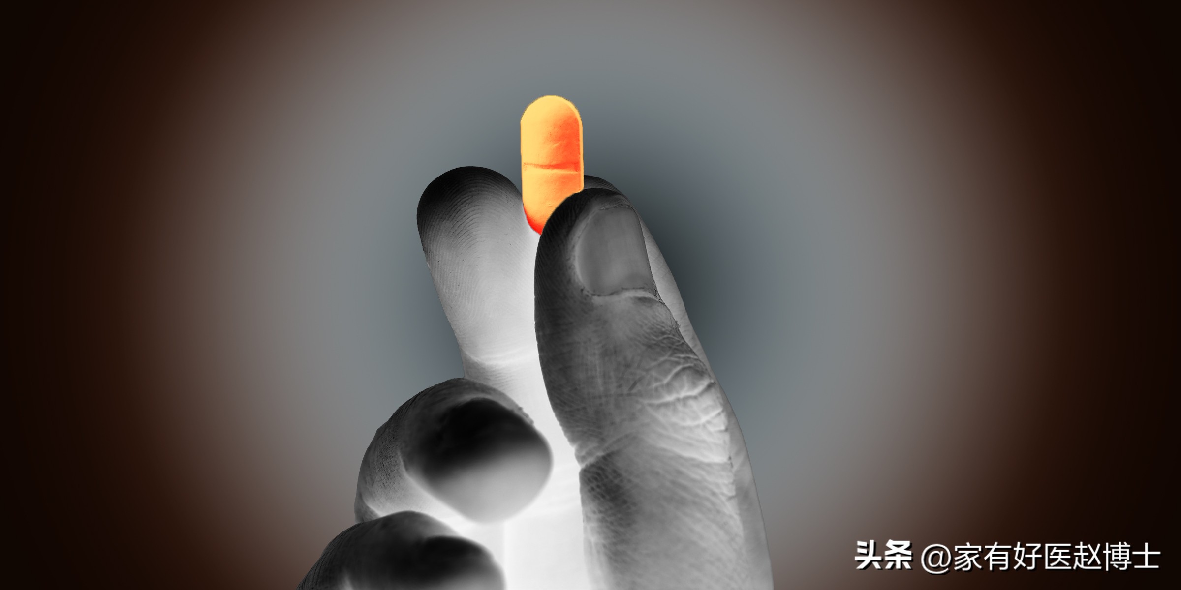 低密度胆固醇ldl偏高需要注意什么,hdl胆固醇偏低是什么意思