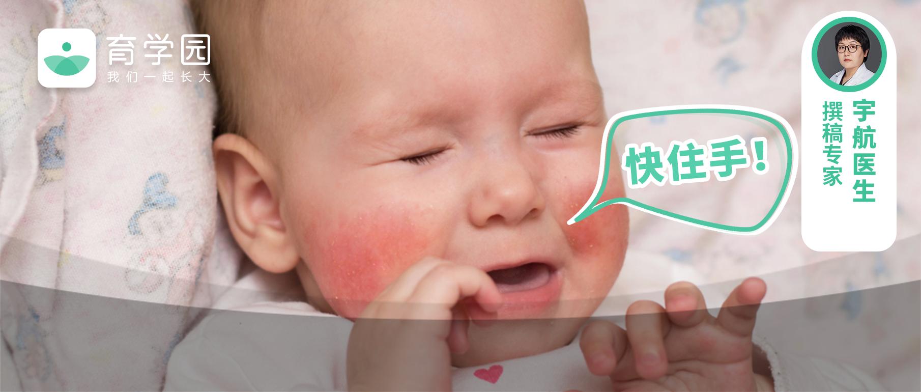 宝宝网红霜,用完宝宝霜长红疹了