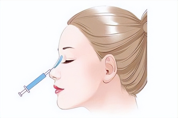 市面上有哪些隆鼻方式,现在的隆鼻技术都是做的微创吗
