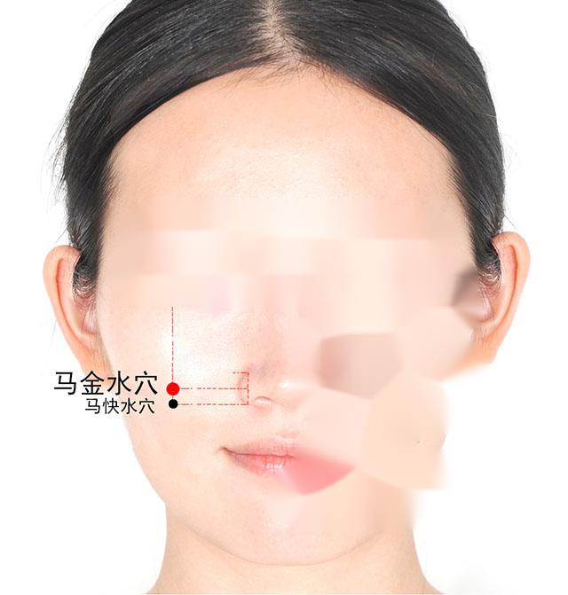 泌尿系疾病针灸,泌尿系统感染针灸哪里最有效