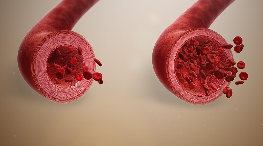 60岁想过夫妻生活,能吃他达拉非吗?上了年纪,怎样维持幸福生活