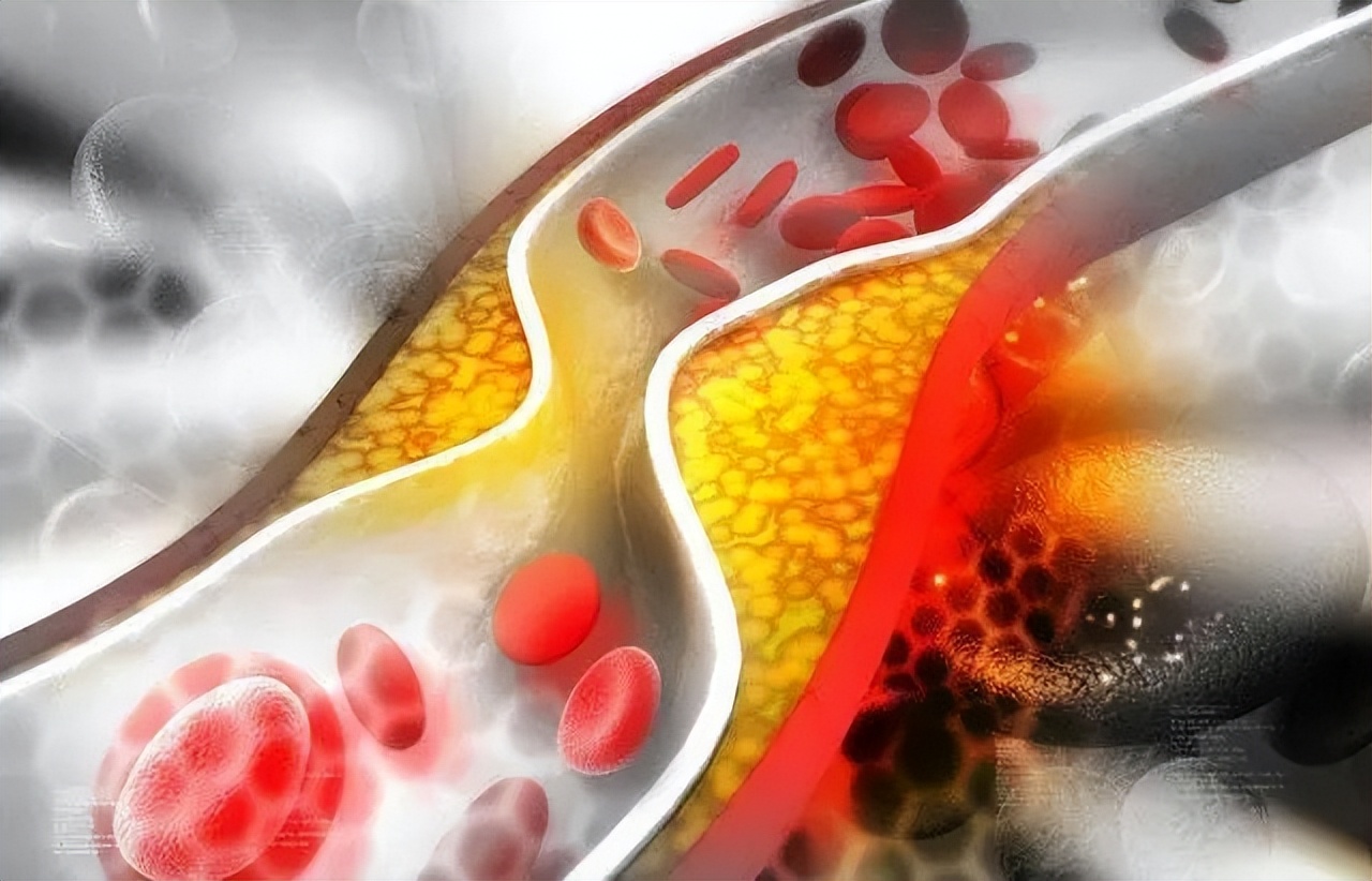 胃黏膜保护剂适合什么样的胃病 (胃黏膜保护剂什么时候服用最好呢)