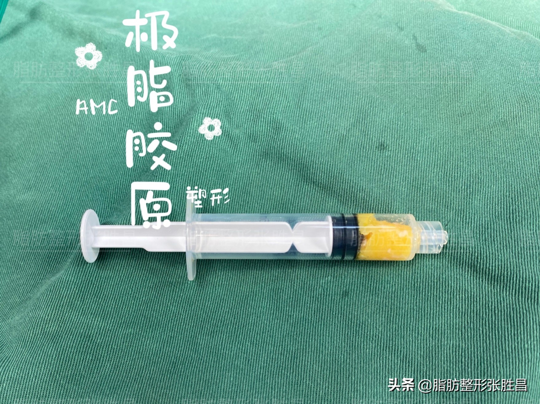 脂肪填充的真相,你不可不知道的面部脂肪填充真相