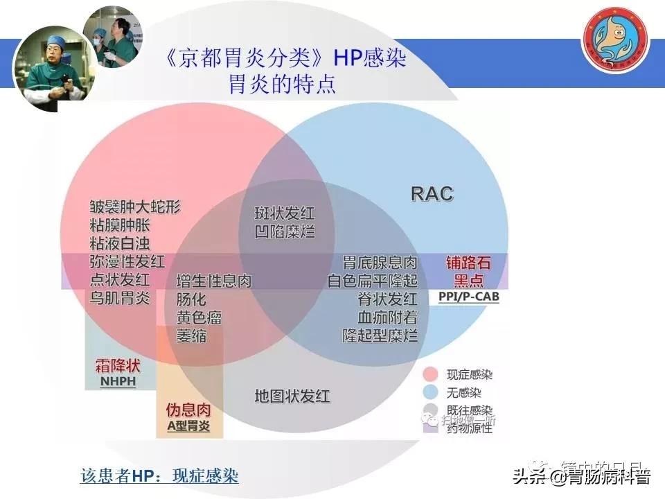 胃癌可以做内镜手术吗,早期胃癌内镜手术后追加外科手术