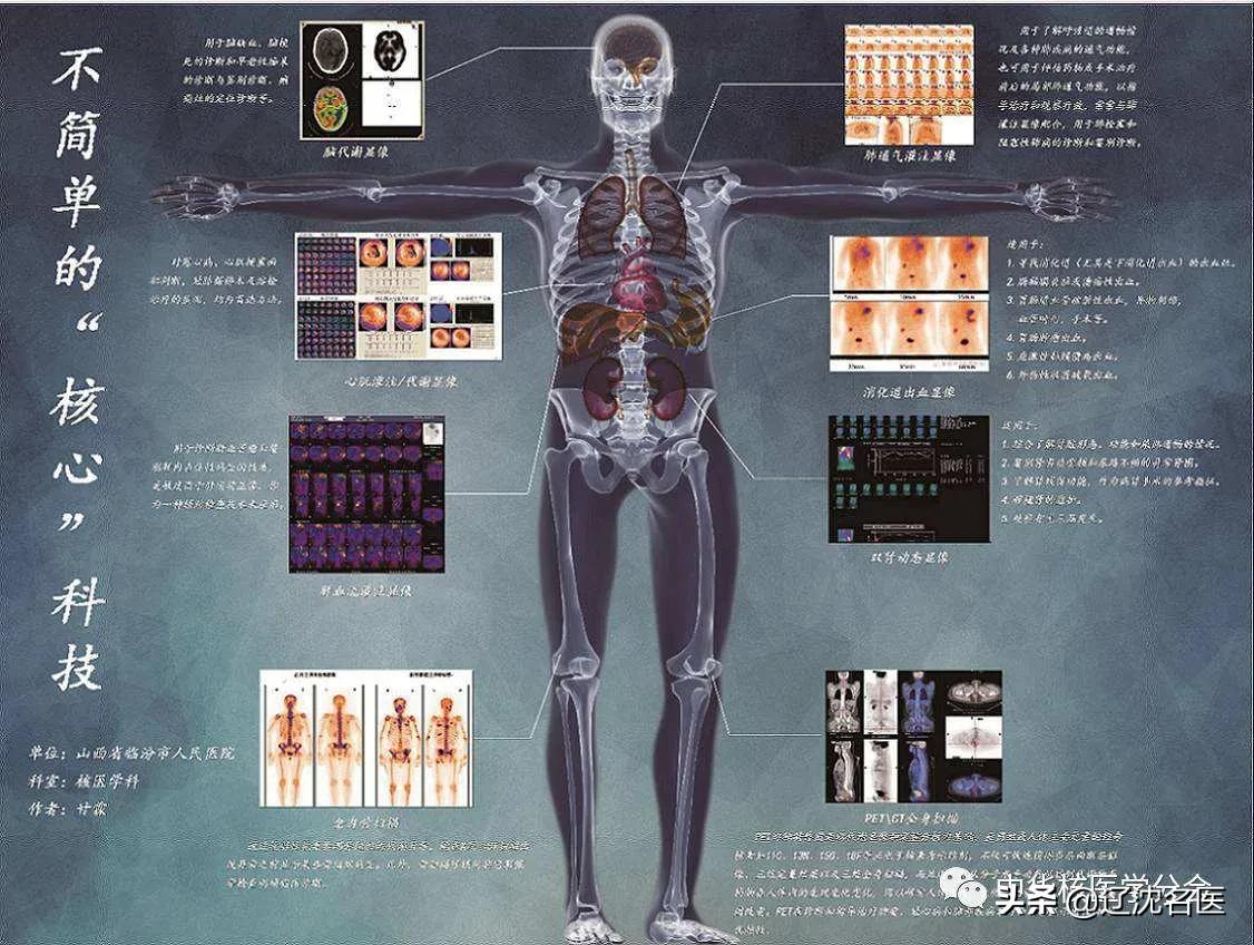 核医学科都有什么检查项目,请详细介绍核医学有关的防护知识