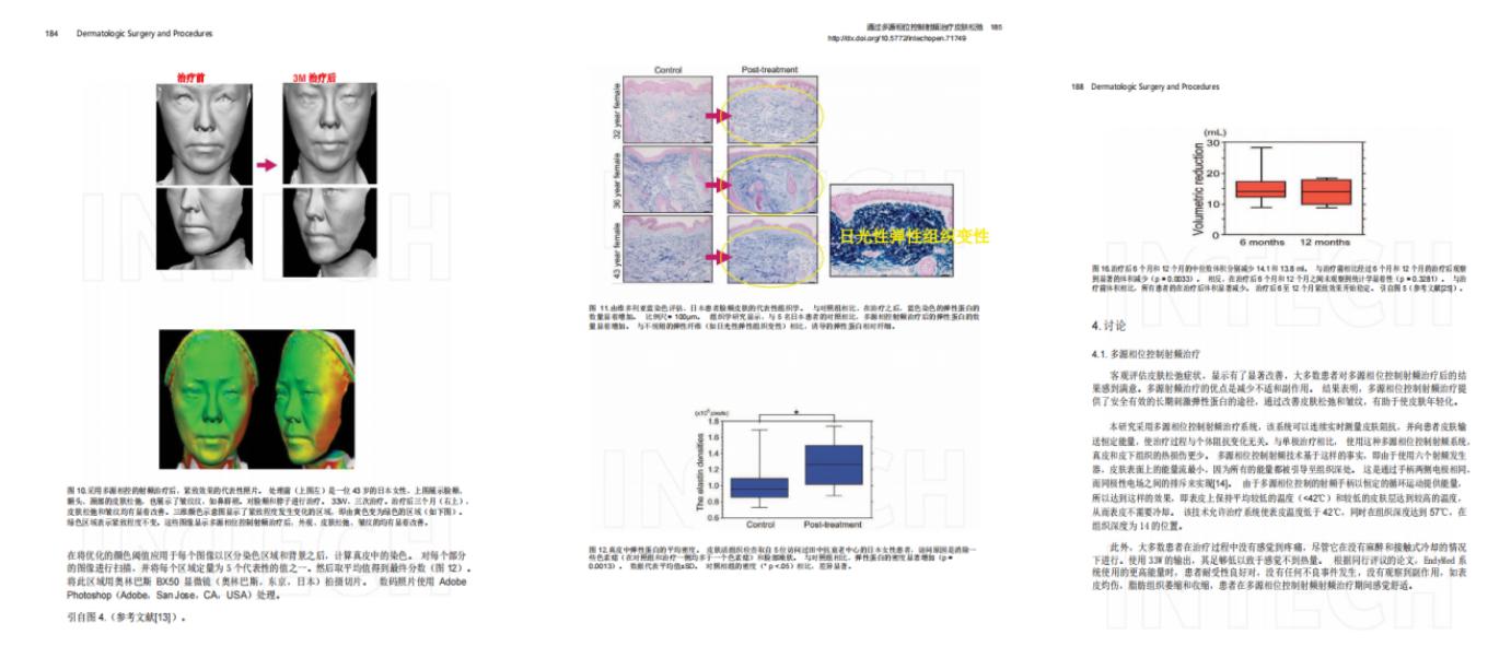 美迪迈相控微针是什么,美迪迈相控微针多久能化妆