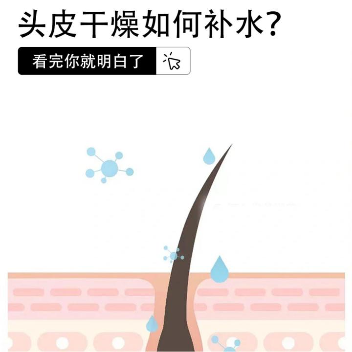 头皮干燥怎么补水最有效,给头皮补水修护的头皮精华