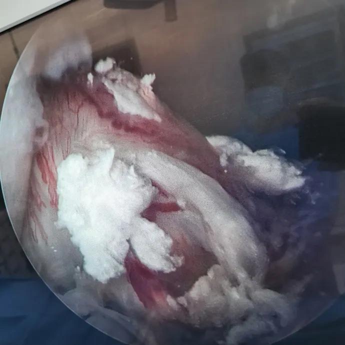 关节部位突然红肿按压有点痛,关节发红有刺痛