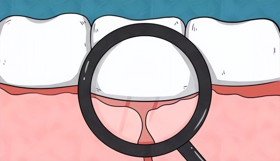 无振感电动牙刷,飞利浦2491电动牙刷测评