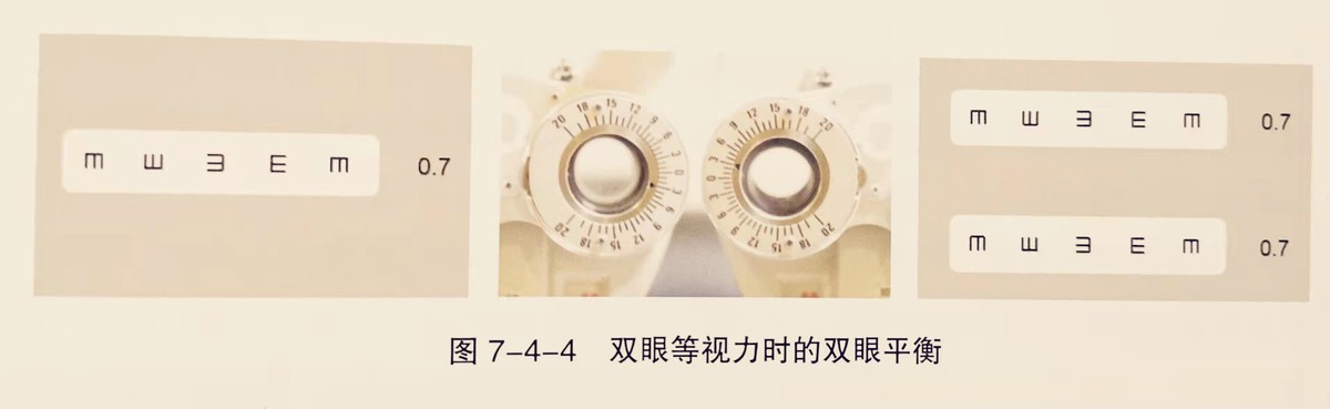 去医院做验光流程,眼镜配镜标准流程表