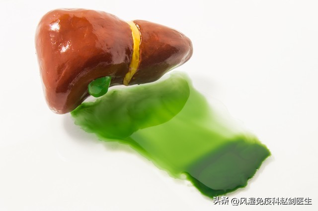 治疗类风湿不伤肝的最佳药物,类风湿药4大禁忌