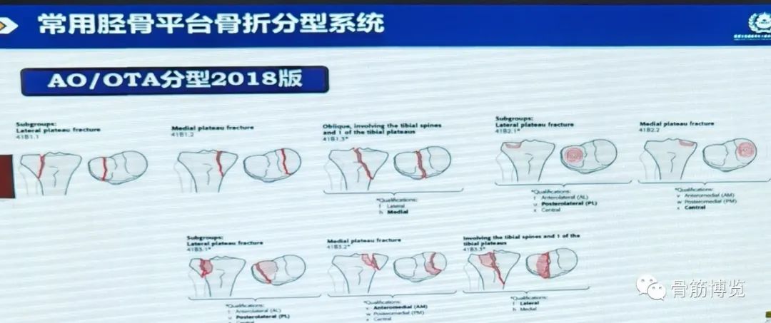 国家卫健委主办的骨创伤专项能力培训项目----下肢损伤学习班
