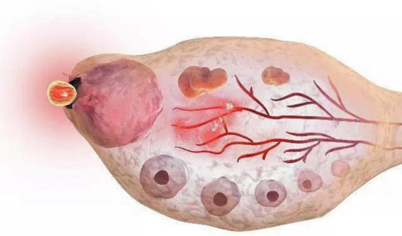 45岁绝经和55岁绝经哪个老得快,45岁绝经和54岁绝经哪个衰老快