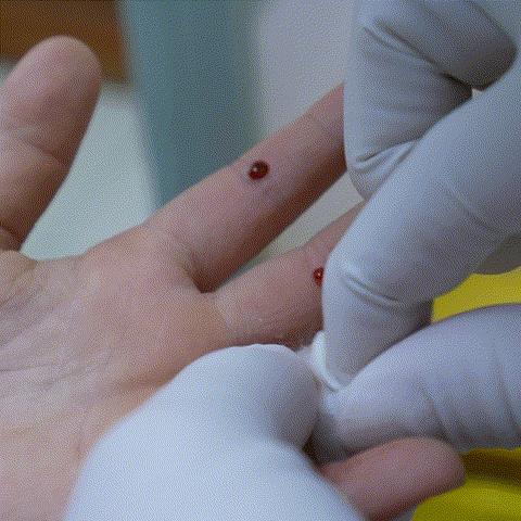 宝宝有疳积是不是喂养不当导致的,疳积适合多大的孩子吃饭