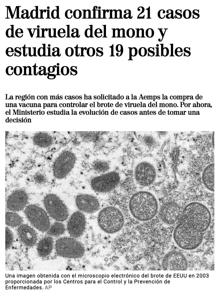 猴痘开始在西班牙蔓延感染方式诡异欧洲各国开始考虑买疫苗
