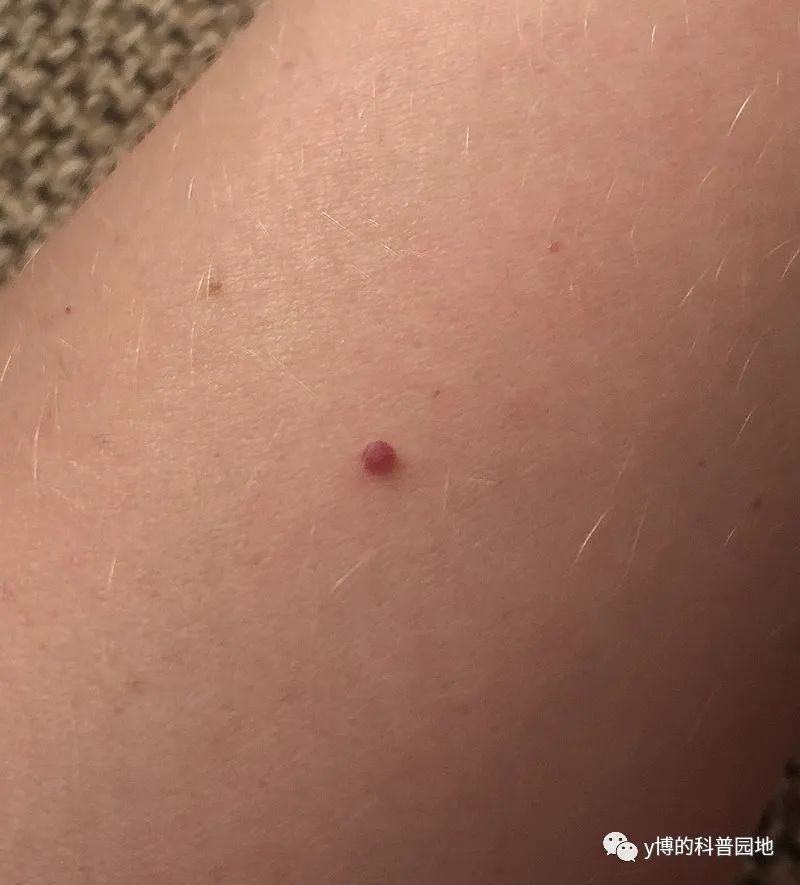 长峰血管瘤医院有门诊与住院之分,长峰血管瘤专科医院小程序