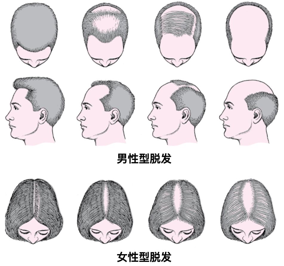拯救头发大作战,保护头发的大作战