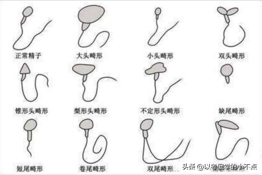 威胁人类的不仅仅是人口老龄化，还有男性精子质和量的急速下降