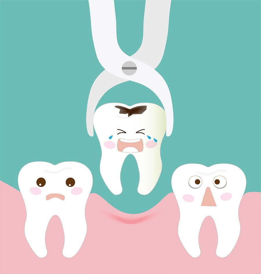 服用抗肿瘤药能拔牙吗,服用抗栓药物可以拔牙吗