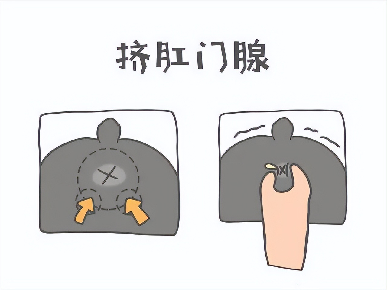 猫咪有肛门腺应该怎么治疗,猫咪有了尿垢怎么办