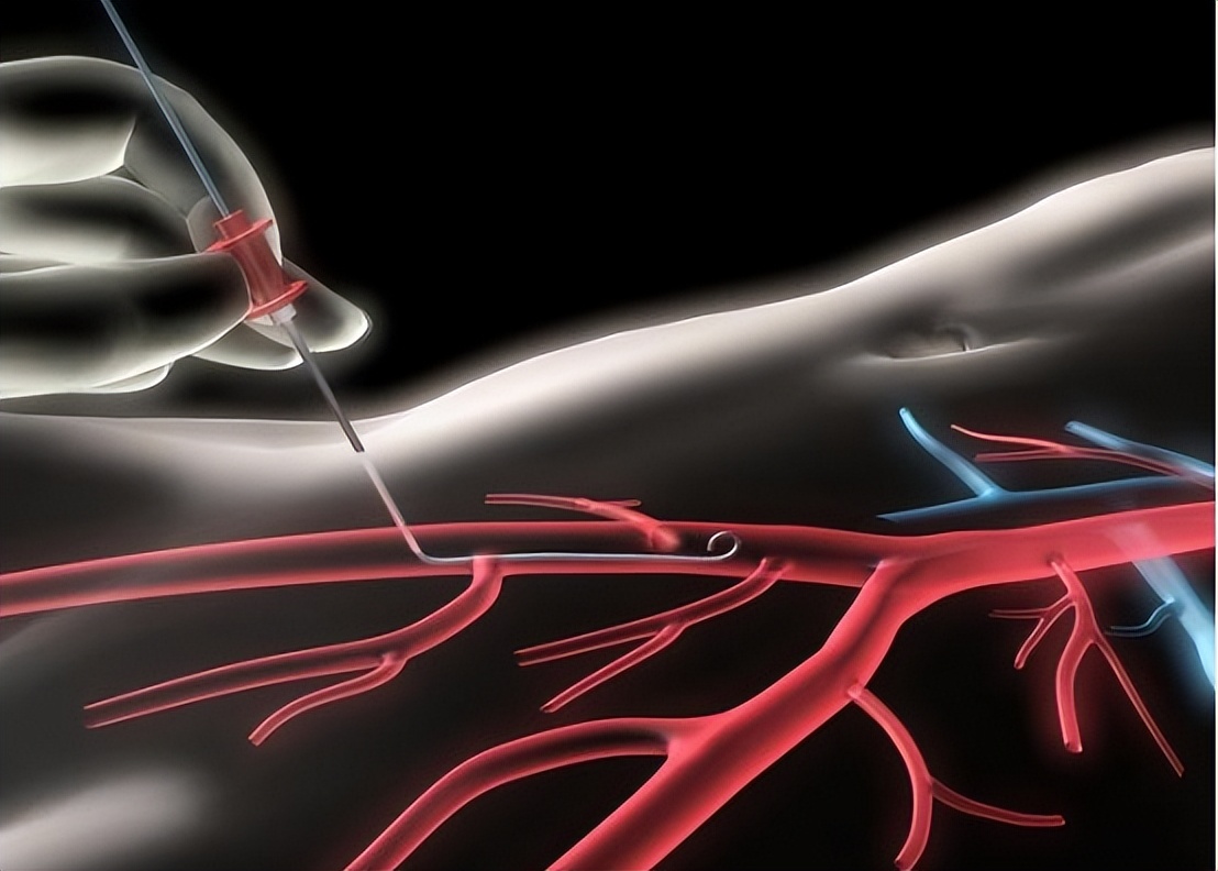 三叉神经痛伽玛刀可以维持多久,三叉神经痛伽玛刀有哪些副作用