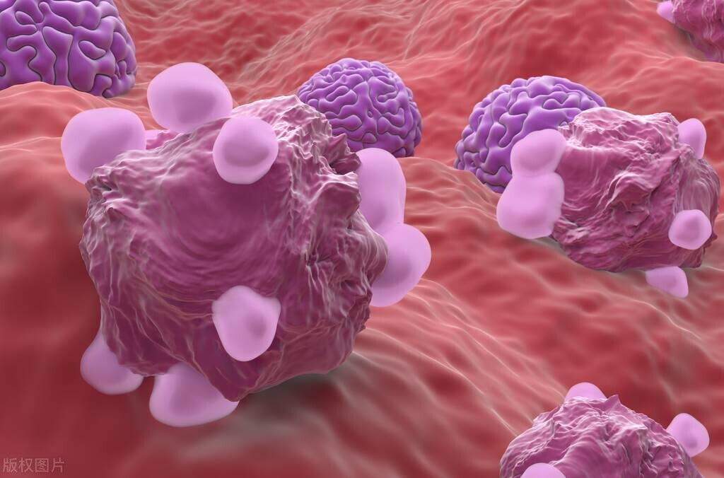 女性身体发臭异味白带褐色,女性有异味发臭正常吗