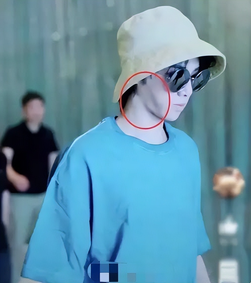 华晨宇下颌骨角度,华晨宇削下颌骨了吗