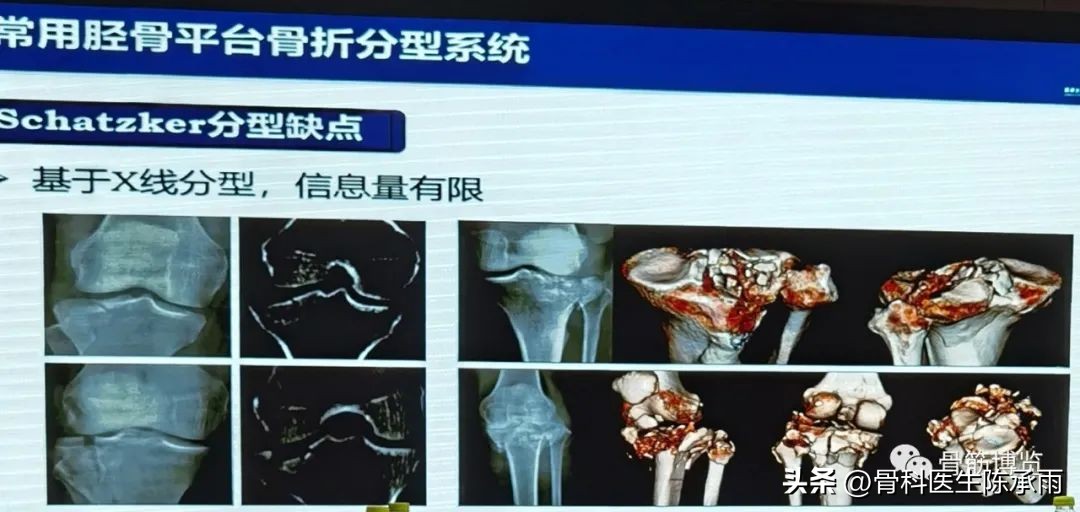 国家卫健委主办的骨创伤专项能力培训项目----下肢损伤学习班