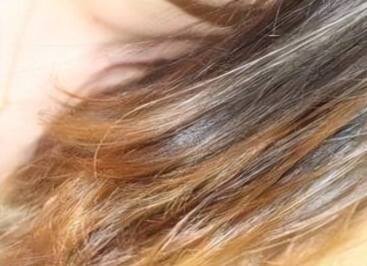 头发怎么看健康状况,头发健康的奥秘