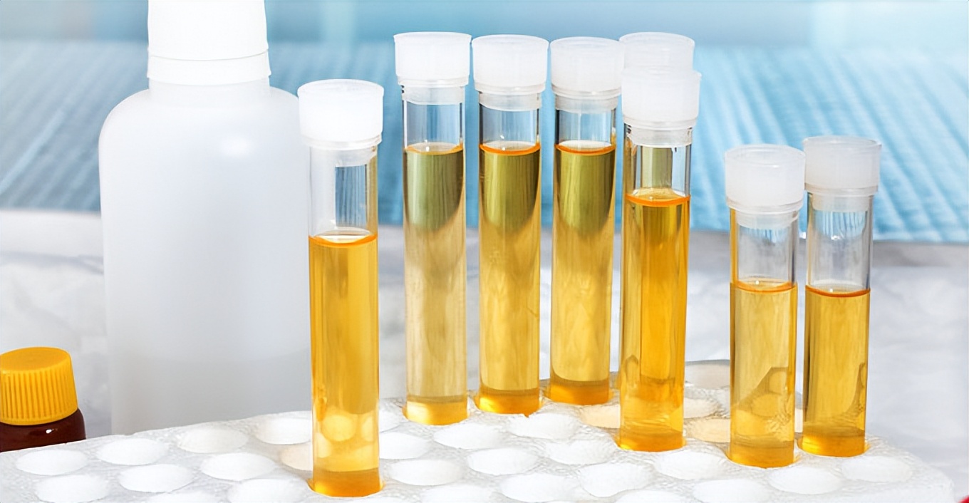 上午尿液颜色深下午尿液颜色无色,尿液颜色像菊花茶的颜色