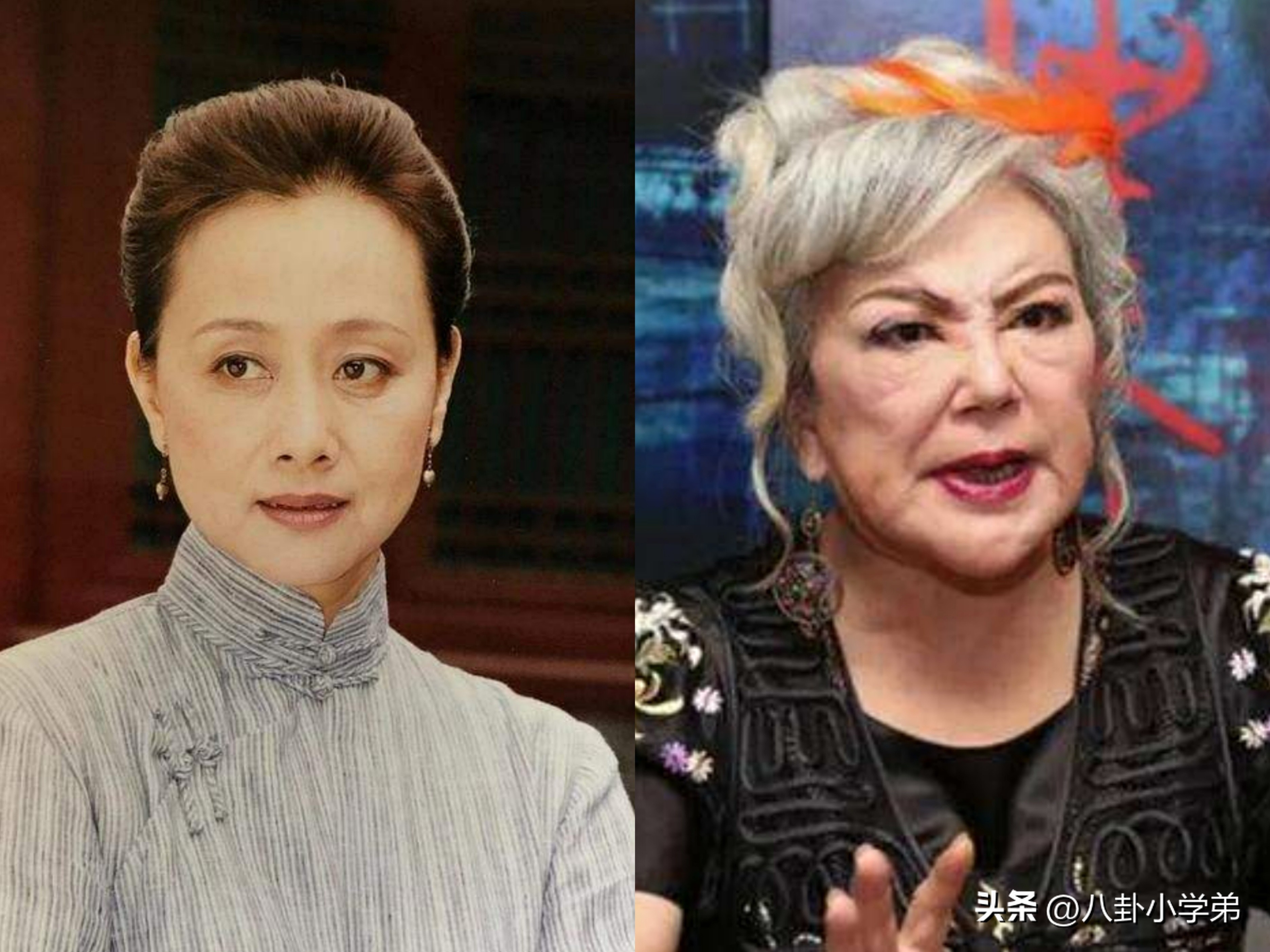 整形脸和真正的美人区别,整形变美的对比图片