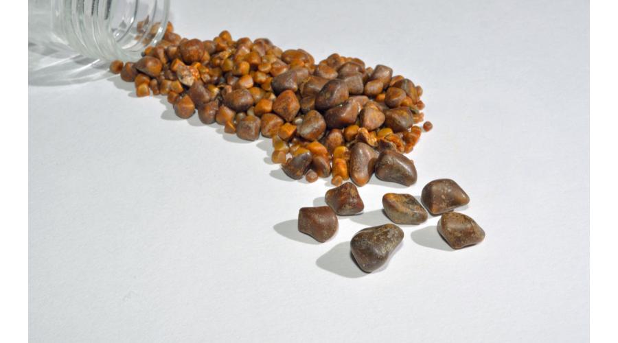 肝硬化有胆结石有胆囊炎怎么治疗,有肝硬化胆结石与胃出血有关吗