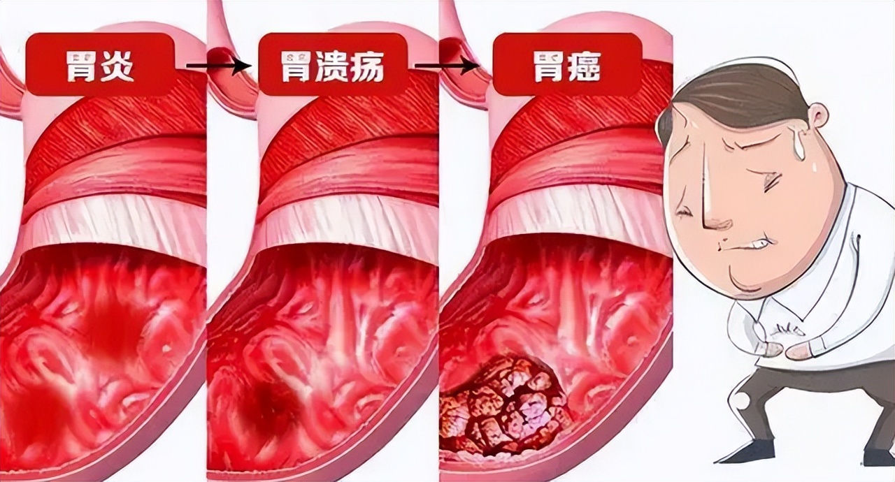 从炎症到癌症三种炎症别拖着,从炎症到癌症以下几种炎症不要拖