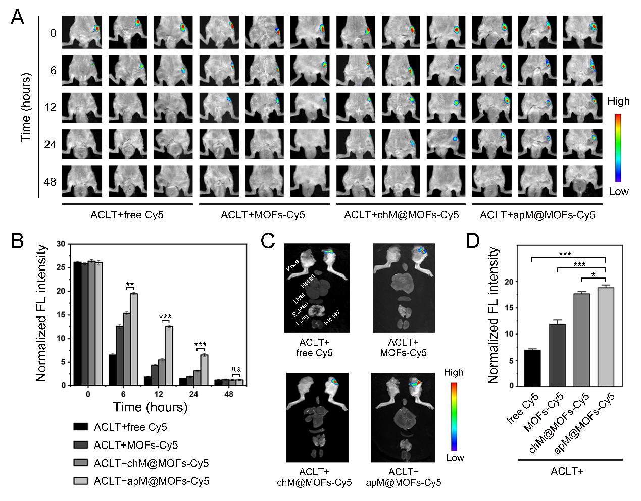 骨关节炎诊治要点及研究进展,骨性关节炎最新研究成果