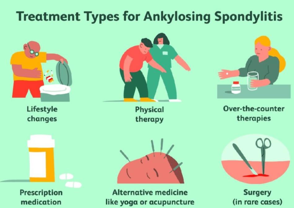 治疗强直性脊柱炎必须按体质治吗,针对强直性脊柱炎最好的锻炼方法