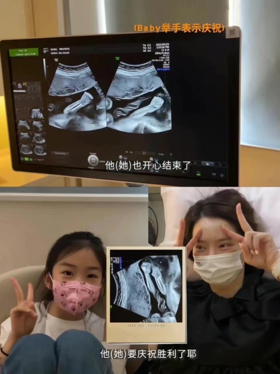 戚薇分享二胎产后首露面照,戚薇自曝产后