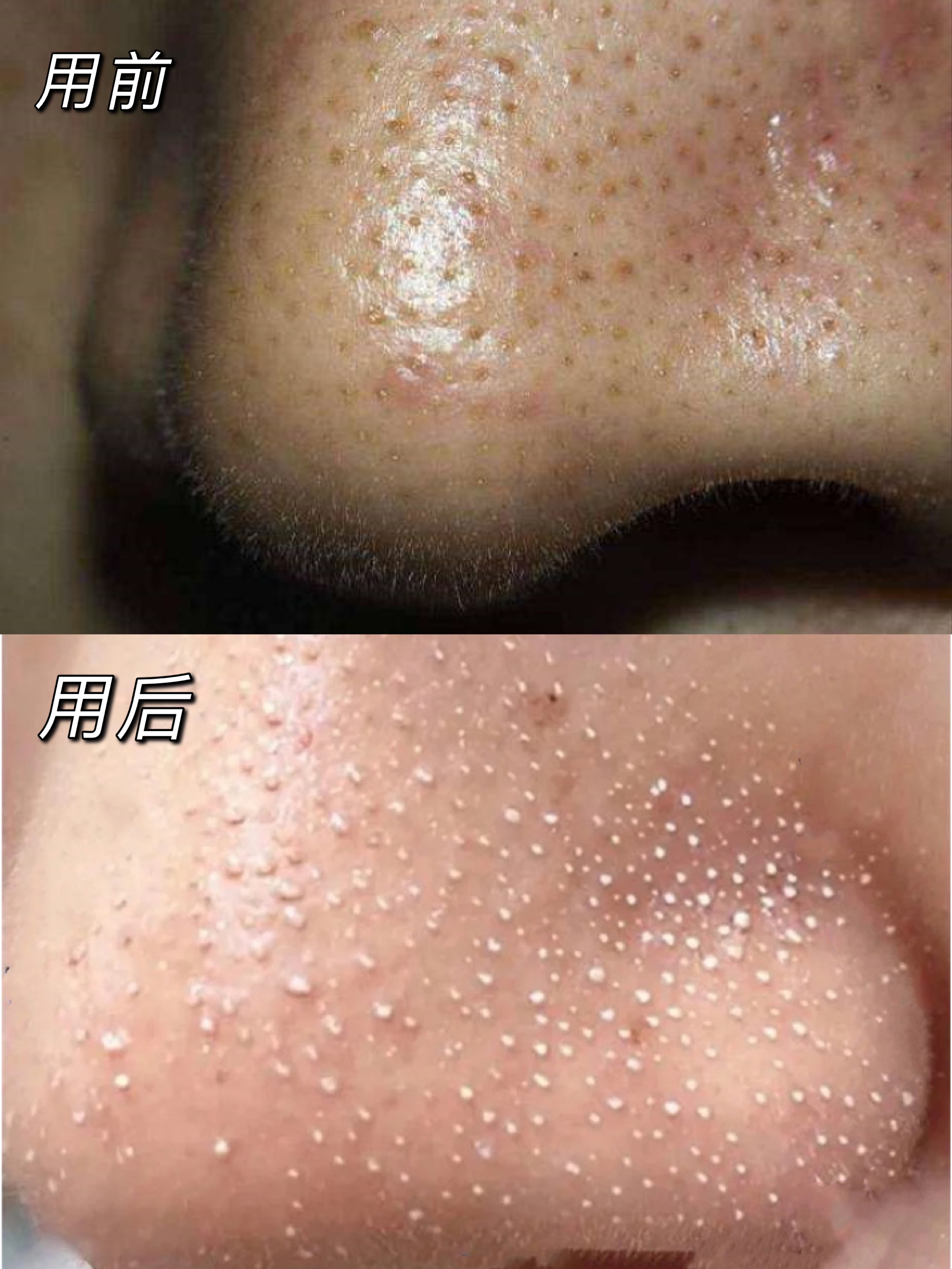 为什么越来越多的人去做美容,为什么越来越多的人去美容院