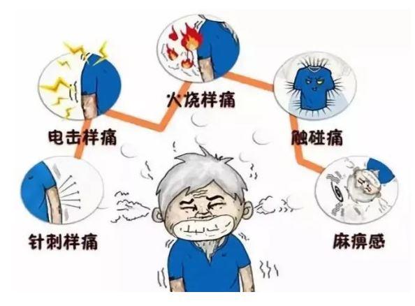 脸上像触电瞬间麻一下,脸上像针扎一样疼怎么回事