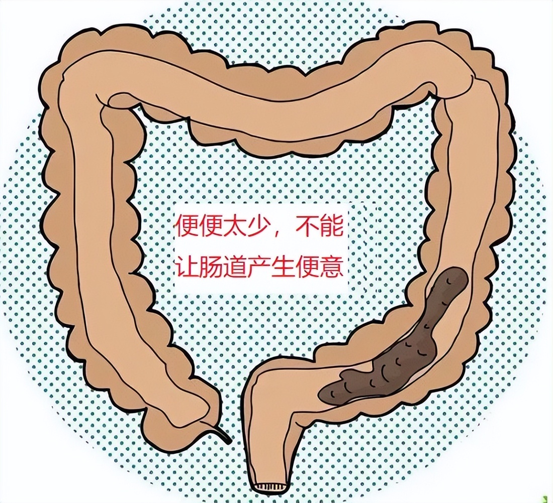 久坐便秘一招解决,便秘就没有办法根治了吗