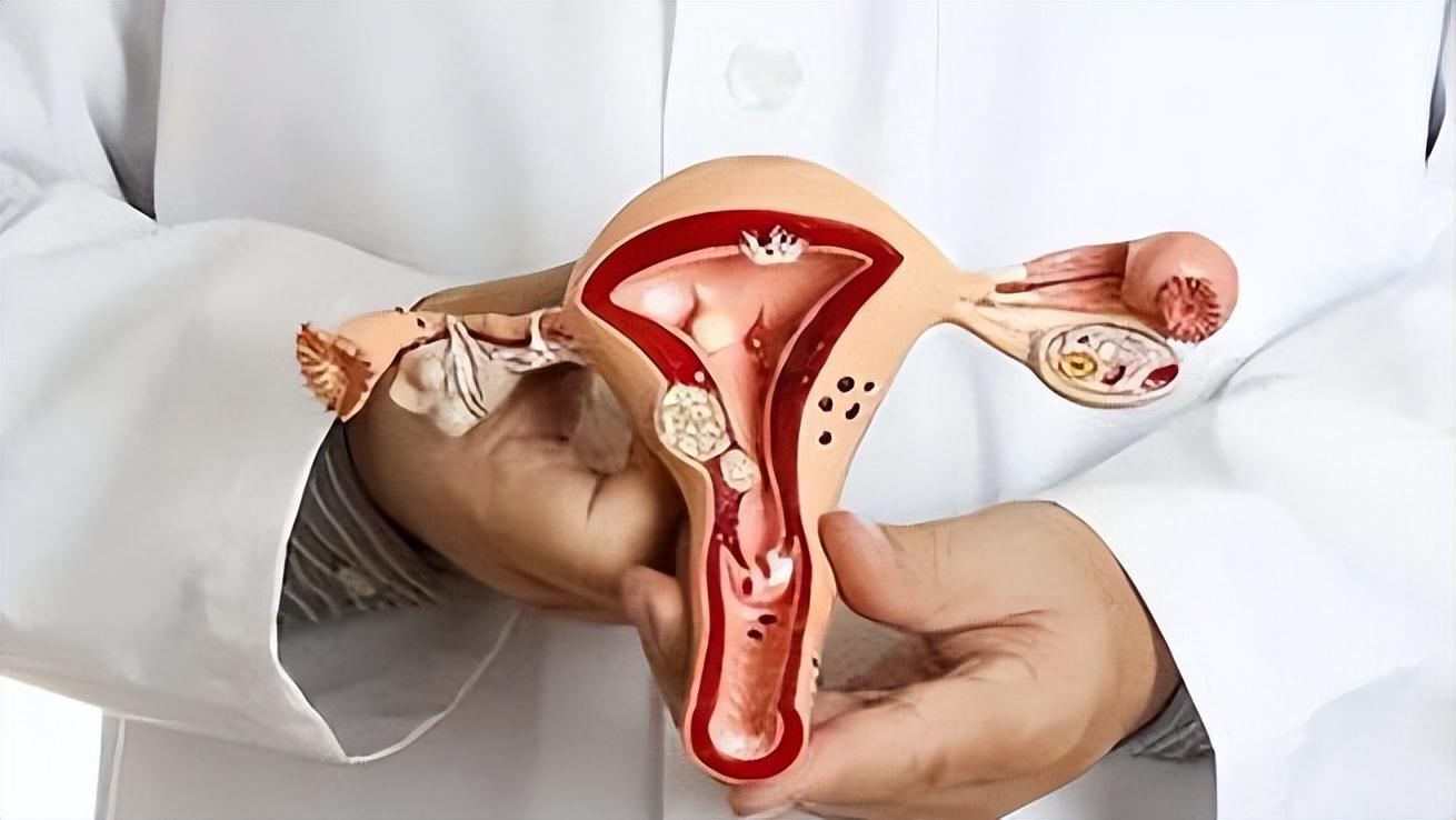 健康女性摘除子宫有影响吗,关爱女性健康不要堕胎